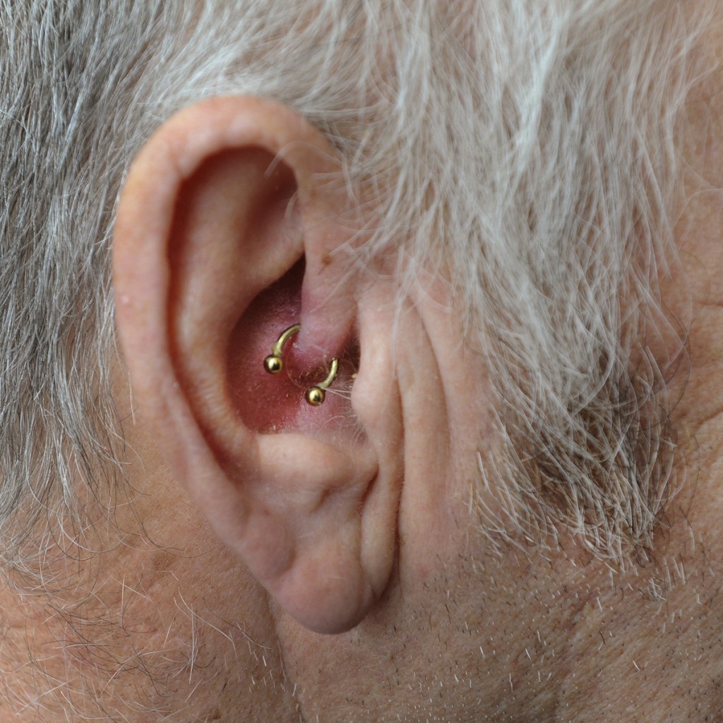Colin Seaman, 70 who has been cured of migraines after having an ear ring. See Masons copy MNMIGRAINE: A pensioner who suffered 50 years of migraines claims to have been miraculously cured - by an EARRING. Colin Seaman, 70, had tried everything from strong drugs to clipping clothes pegs to his face to stop the excruciating pain caused by migraines. Father of two Mr Seaman began to suffer from migraines when he was 20, which would knock him for six. He had numerous treatments from doctors to try and take away the pain including injections around his eyes.