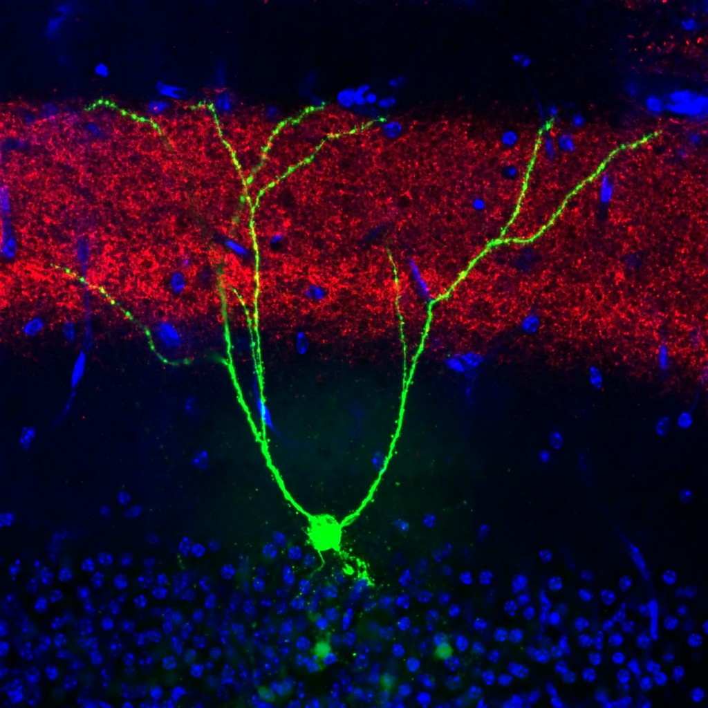 Depicts a single memory engram cell in the hippocampal dentate gyrus region of a mouse model of early Alzheimer's disease - Copyright National News and Pictures - Credit RIKEN