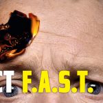 Act F.A.S.T. - Symptoms of a stroke